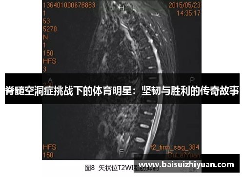 脊髓空洞症挑战下的体育明星：坚韧与胜利的传奇故事
